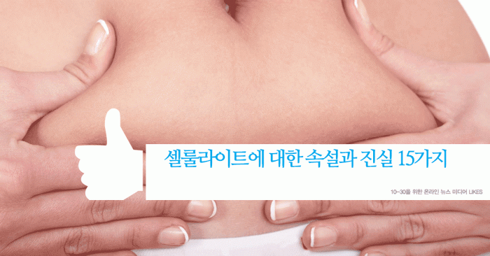 cellulite